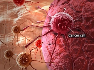 salud-cancer-WB