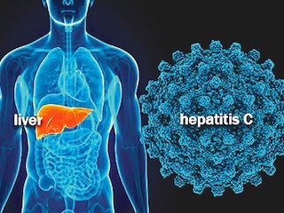 web-62salud-hepatitisC