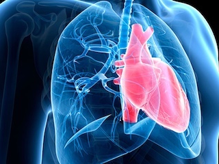 web-75-hipertension-pulmonar