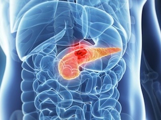 web-62-salud-Cancer-pancreas