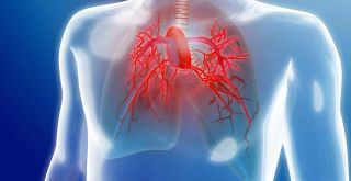 Hipertension pulmonar