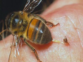 veneno-abeja